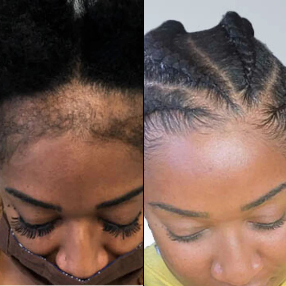 Huile de Batana Brute 100 % Pure